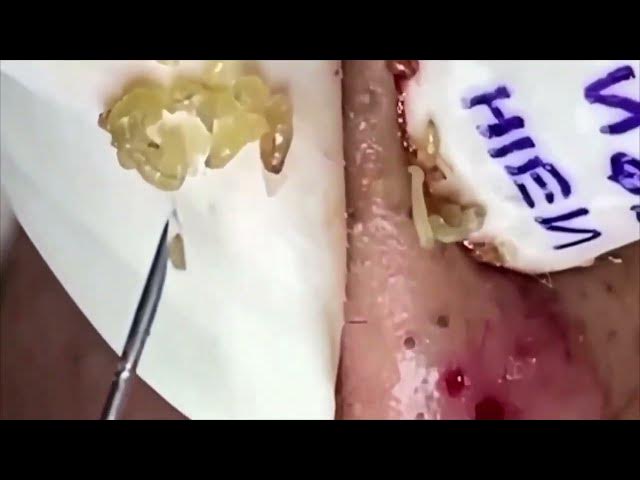 Video thumbnail for Satisfying Relaxing Relax Every SacDepSpa Hours #100001