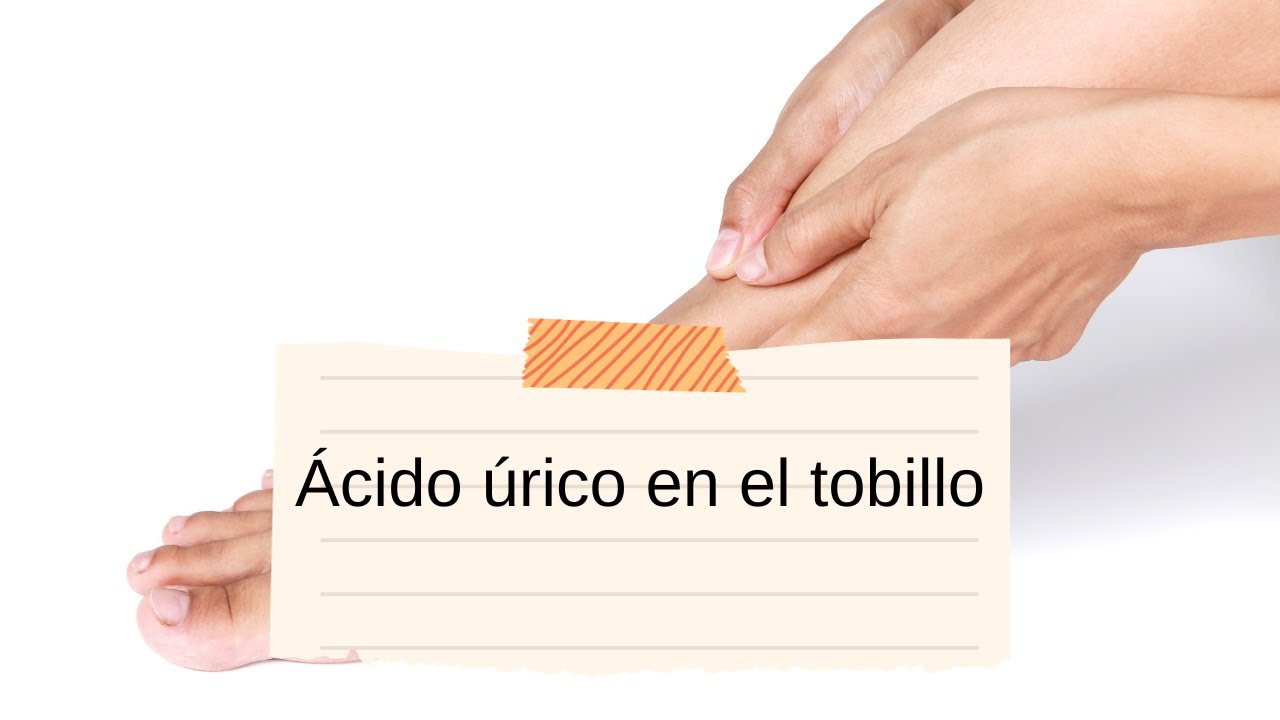 'Video thumbnail for Ácido úrico en el tobillo: video blog'