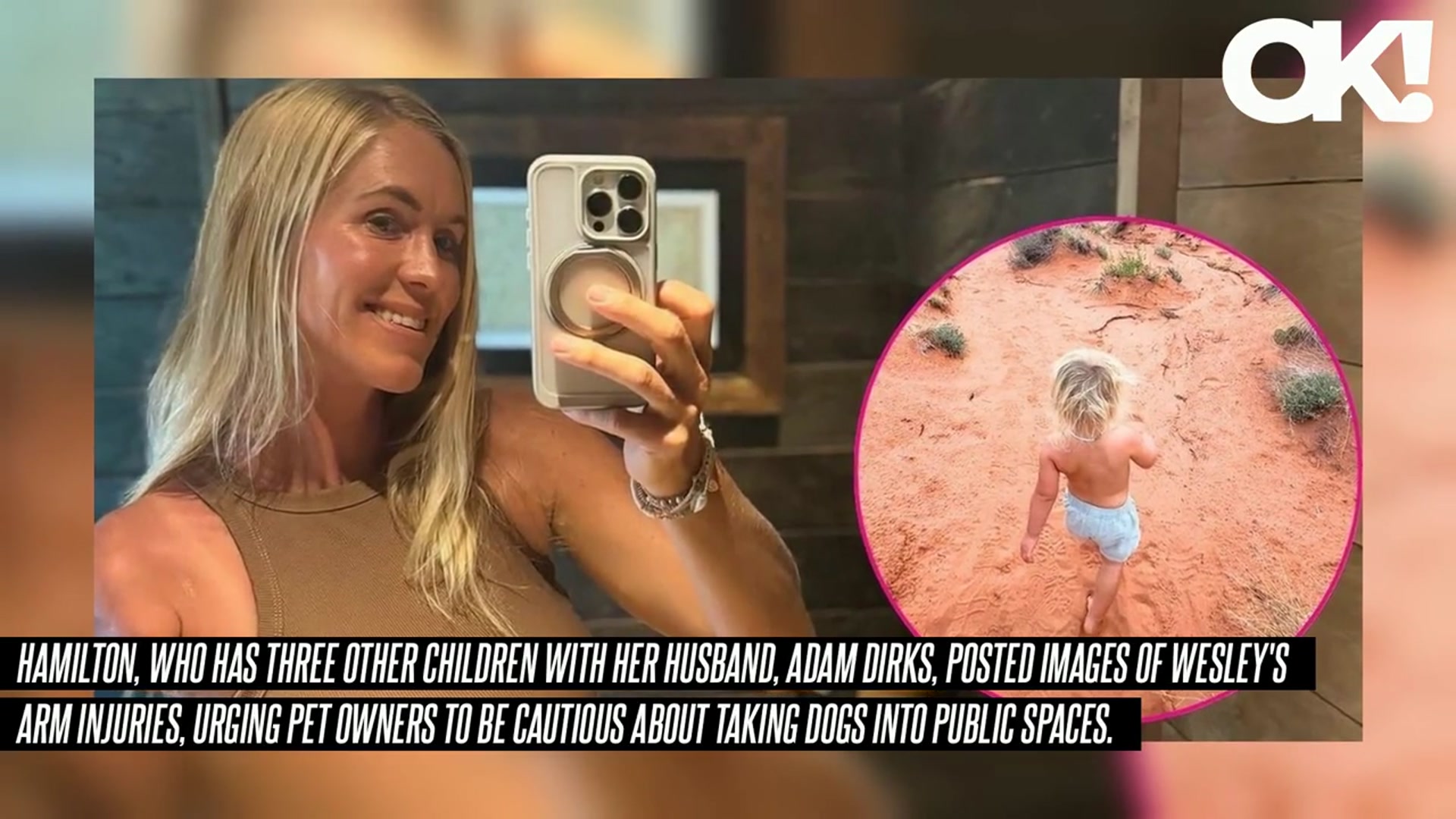 'Video thumbnail for Bethany Hamilton Calls Out Dog Owners After Son's Terrifying Bite Incident'