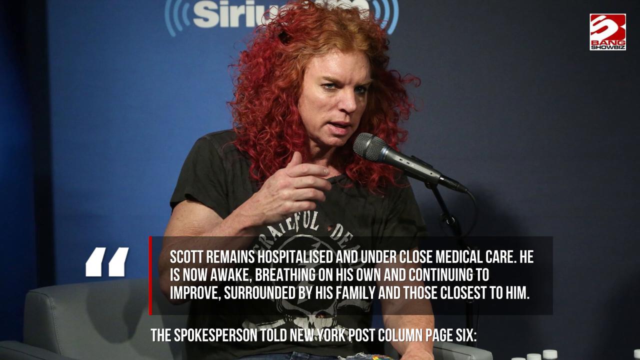 Video thumbnail for Carrot Top discharged from hospital.
