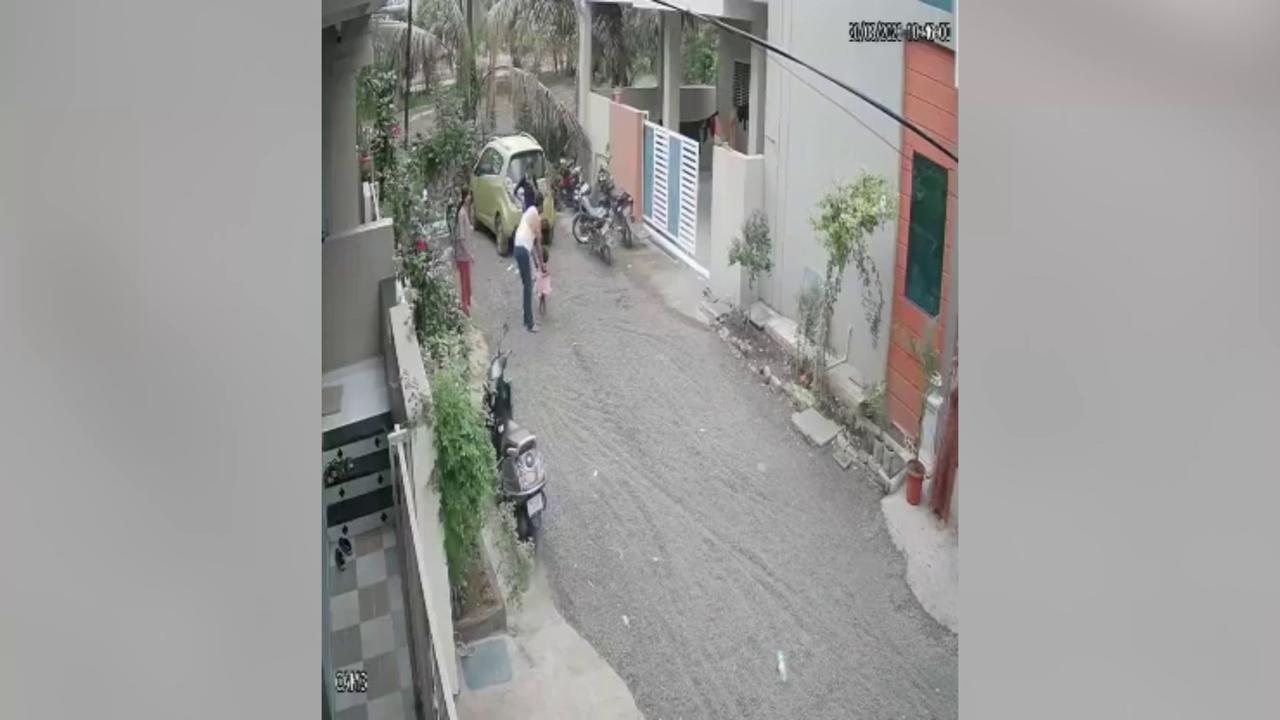 Video thumbnail for India: Two-year-old girl attacked by stray dog while playing outside home, severe facial injuries lead to ICU treatment.