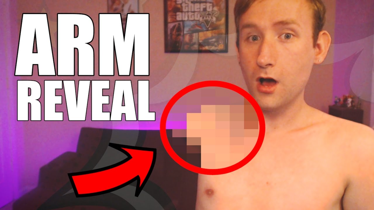 Video thumbnail for ARM REVEAL - I'm a Right-Arm Amputee