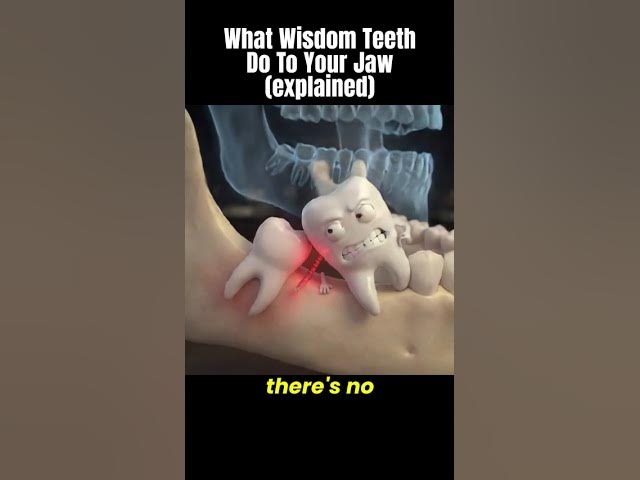 Video thumbnail for What Wisdom Teeth Do To Your Jaw (explained)