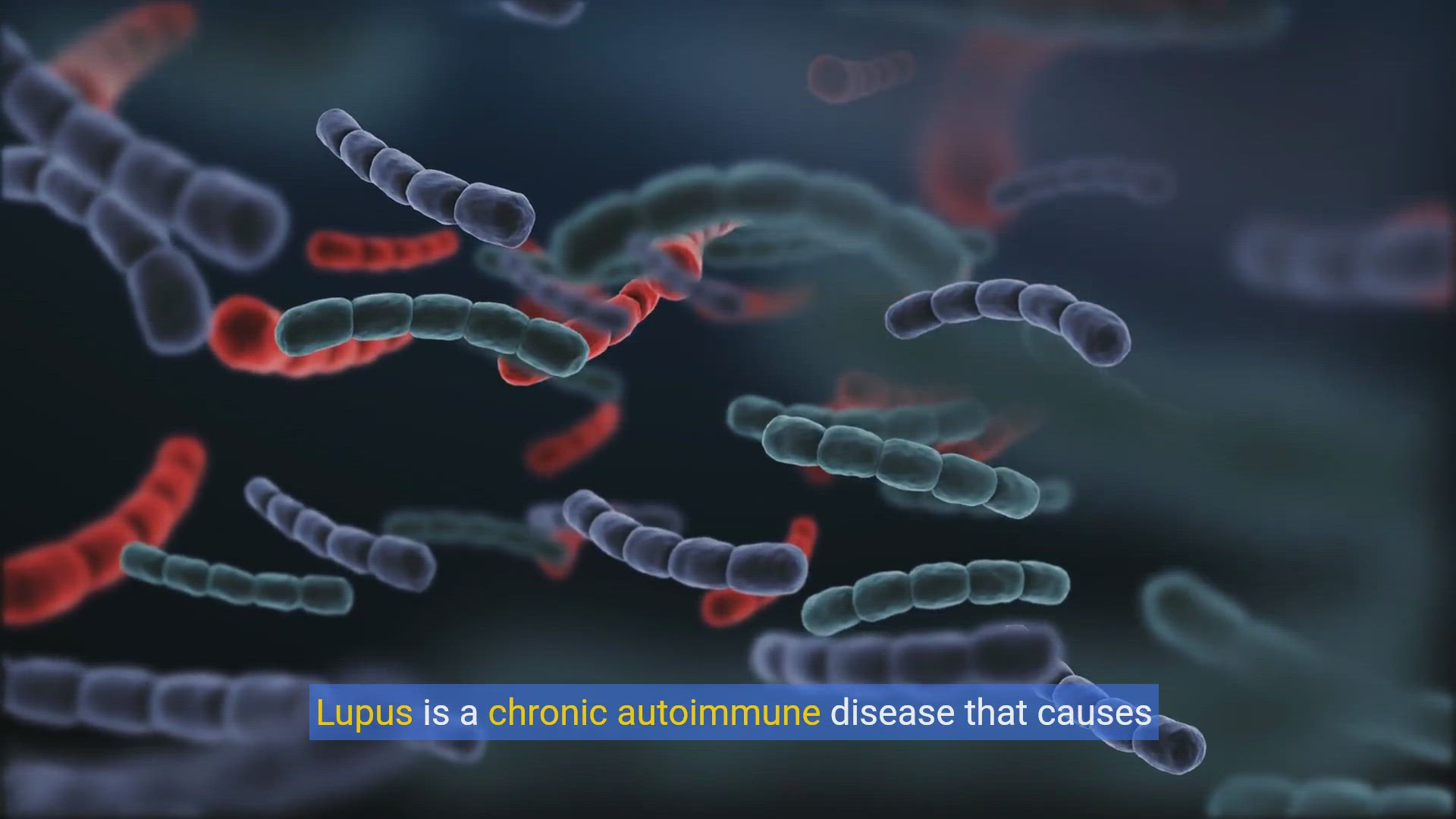 'Video thumbnail for Nutrition and Lupus: Eating Well for Better Health'