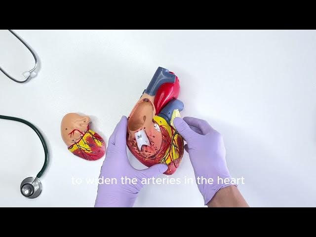 Video thumbnail for Navigating Coronary Artery Disease  From Modern Me