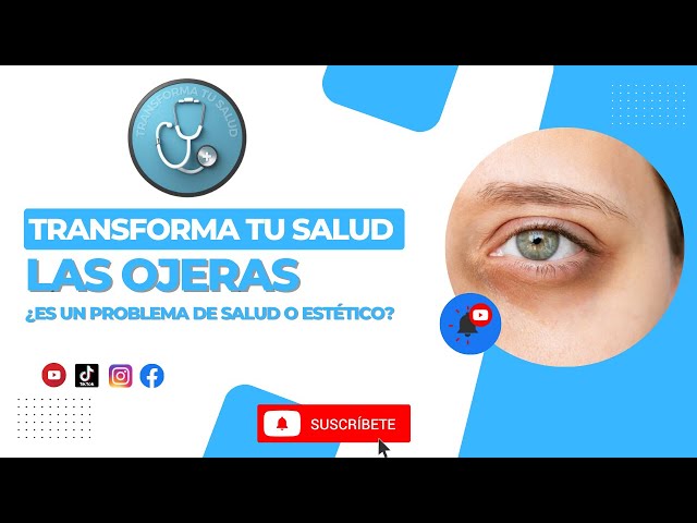 Video thumbnail for LAS OJERAS, ¿ES UN PROBLEMA DE SALUD O ESTÉTICO?