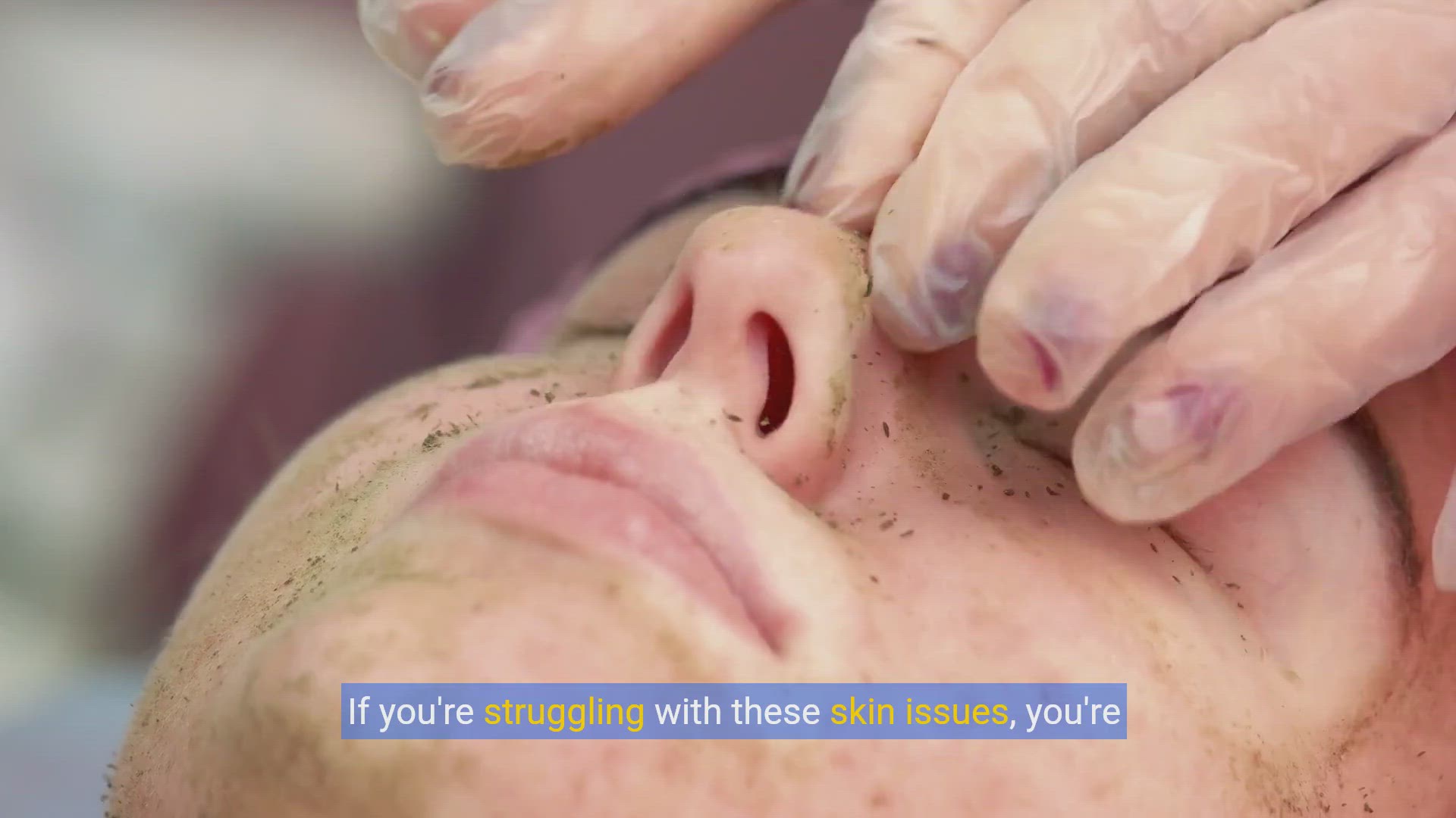 'Video thumbnail for Spot Treatments 101: Effective Solutions for Blemishes and Dark Spots'