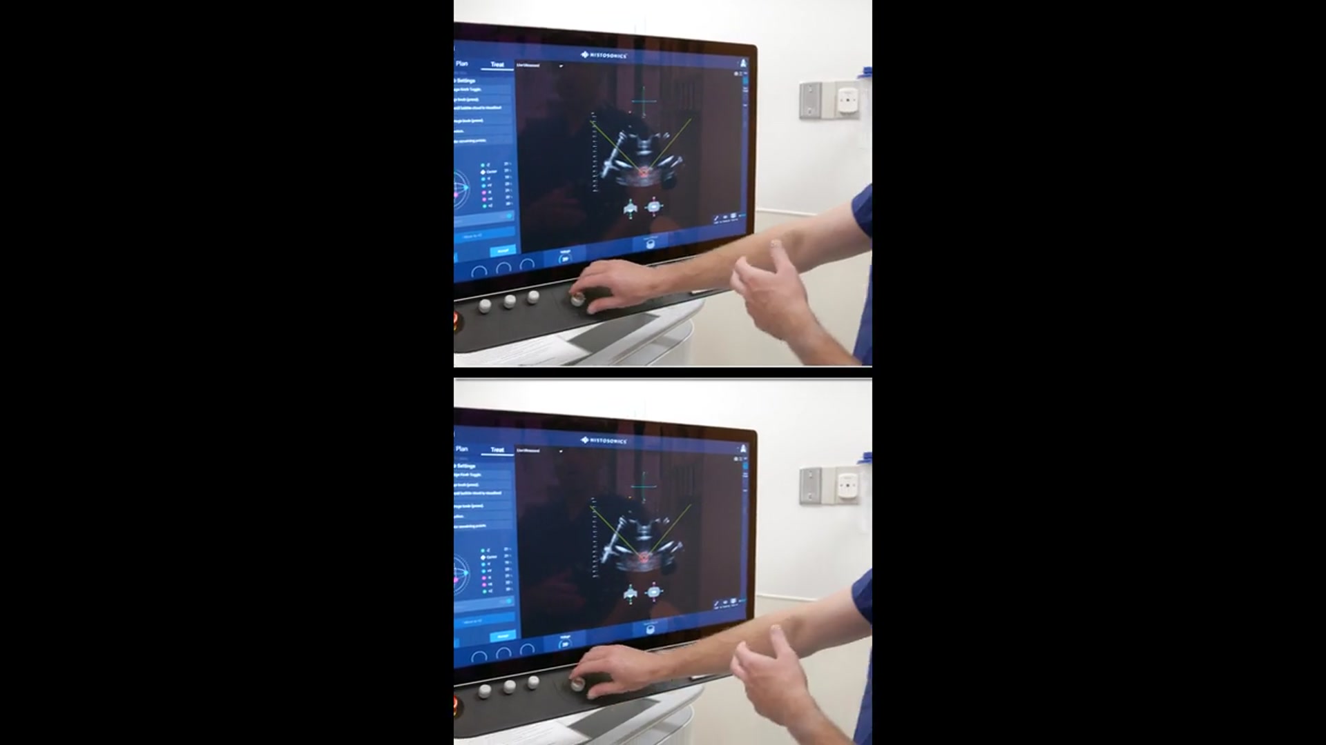 Video thumbnail for Destroying Tumors with SOUND