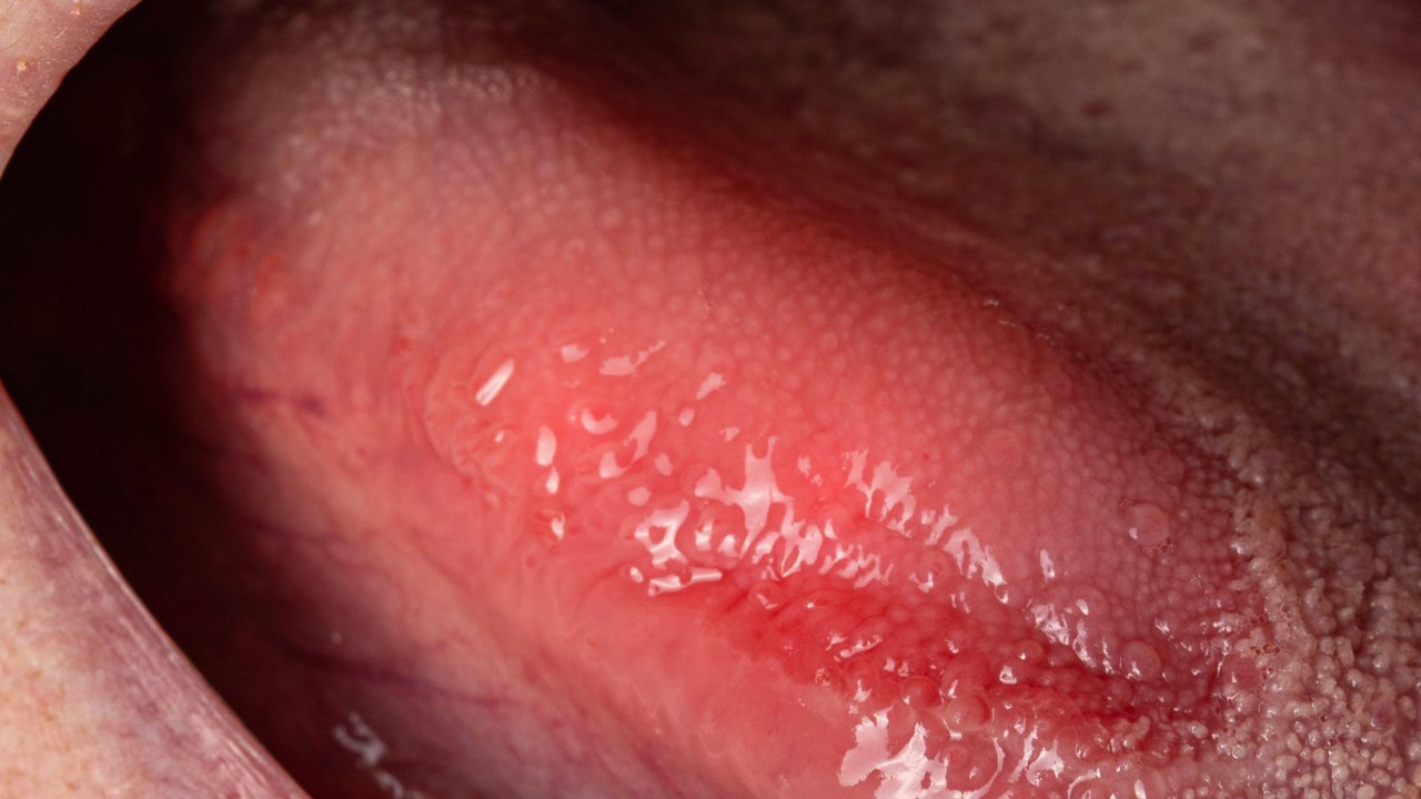 Video thumbnail for The Silent Deficiency: Unraveling the Impact of Vitamin D Insufficiency