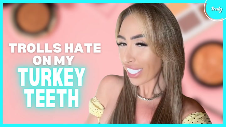 Video thumbnail for Haters Say My Turkey Teeth Are "A Joke" | HOOKED ON THE LOOK