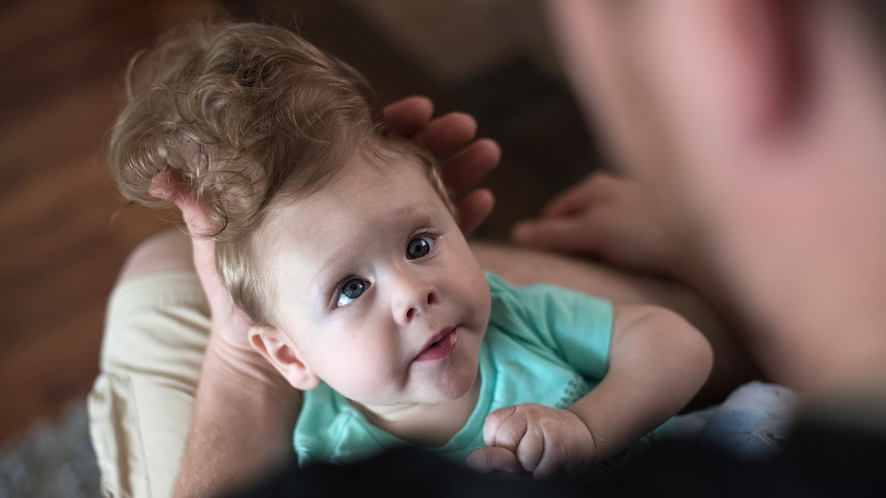 Video thumbnail for Saving Bentley's brain: Daring surgery aims to fix a gaping hole in baby's skull