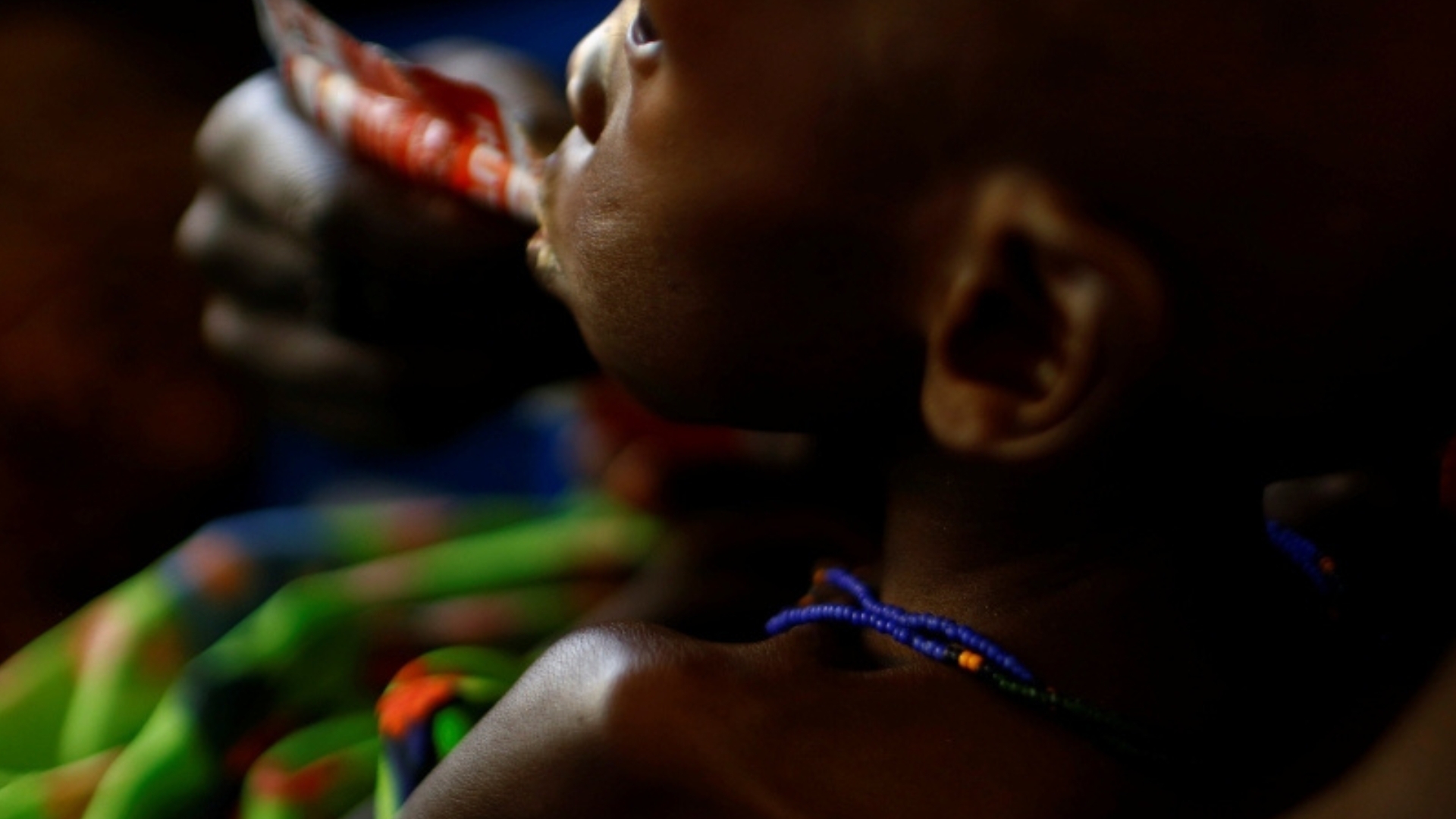 Video thumbnail for South Sudan hunger : Escalating violence causing widespread malnutrition