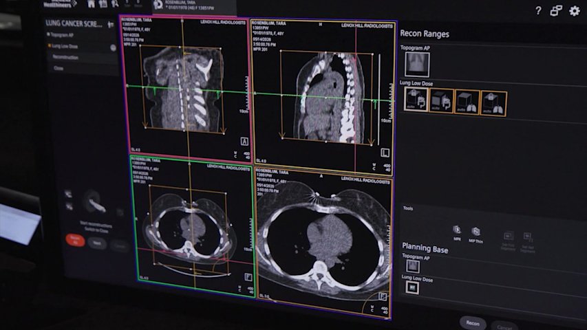 Video thumbnail for How AI and new tech are fighting the tri-state's deadliest cancer