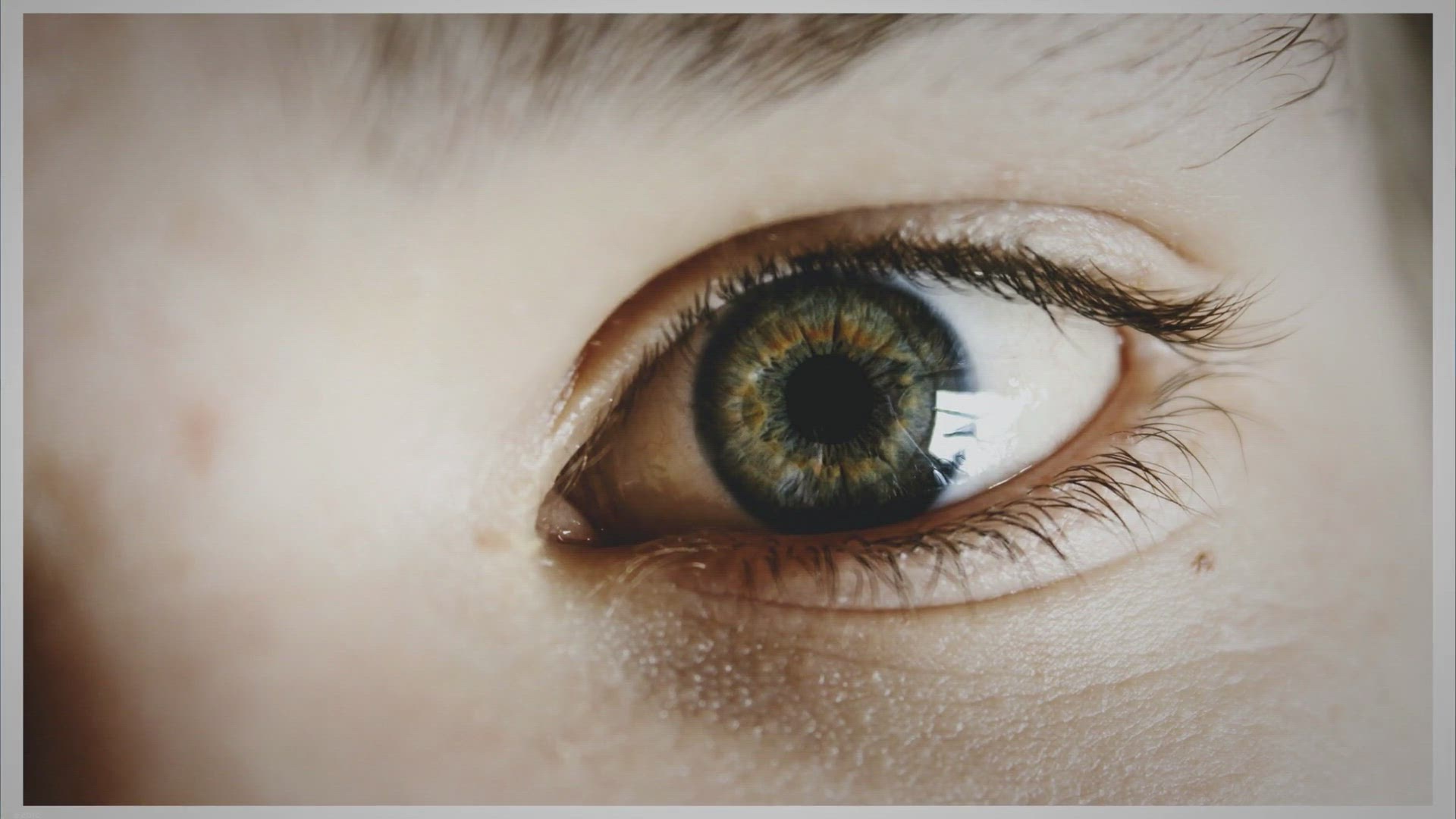 'Video thumbnail for Cataract Eye Surgery: A Comprehensive Guide'