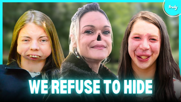Video thumbnail for Living With The Rarest Facial Conditions | BORN DIFFERENT