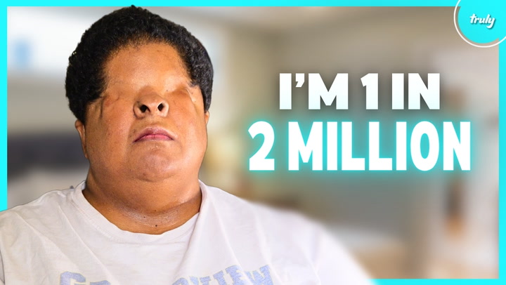 Video thumbnail for I’m A Single Mom-Of-2 Born Without Eyes | BORN DIFFERENT