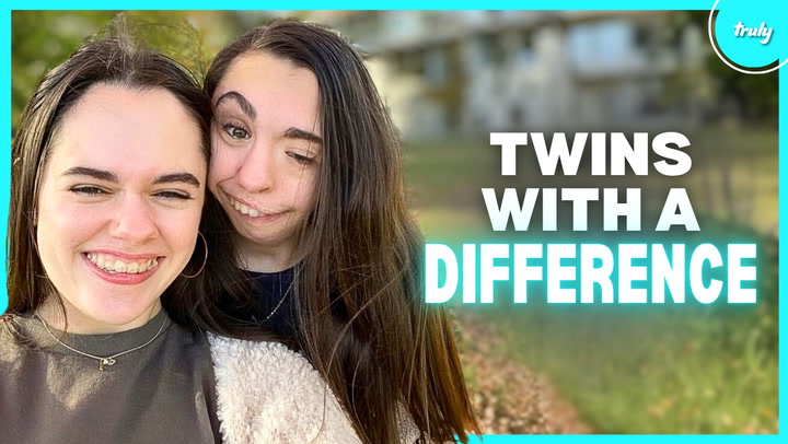 Video thumbnail for My Twin Was Born Without An Ear & Jawbone | BORN DIFFERENT