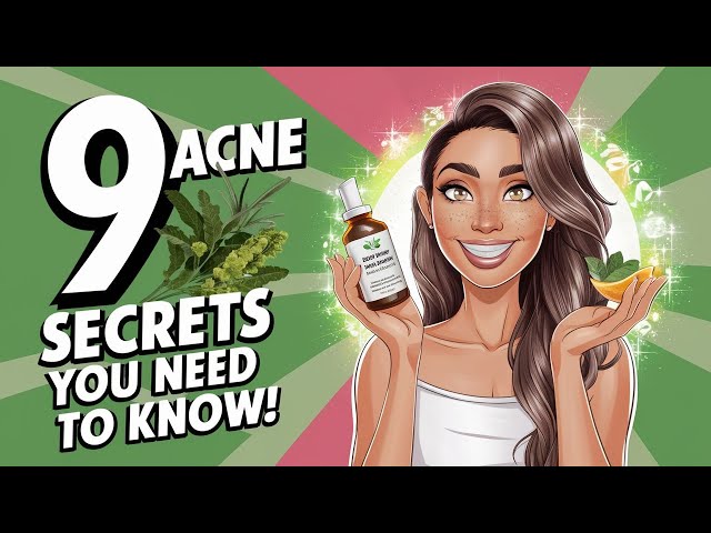 Video thumbnail for How to Get Rid of Acne Naturally – 9 Effective Secrets!