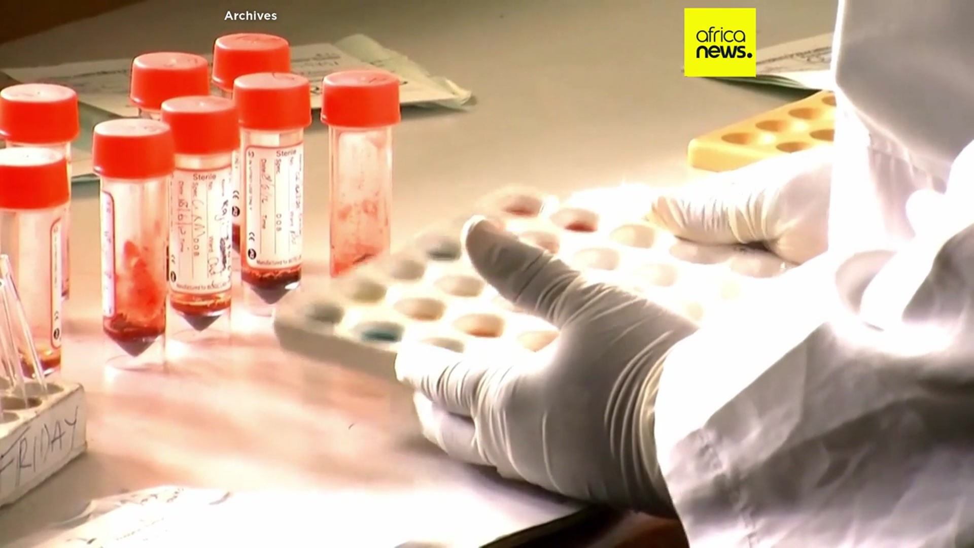 'Video thumbnail for WHO reports rapid spread of Mpox with 17 deaths in Africa over recent weeks'