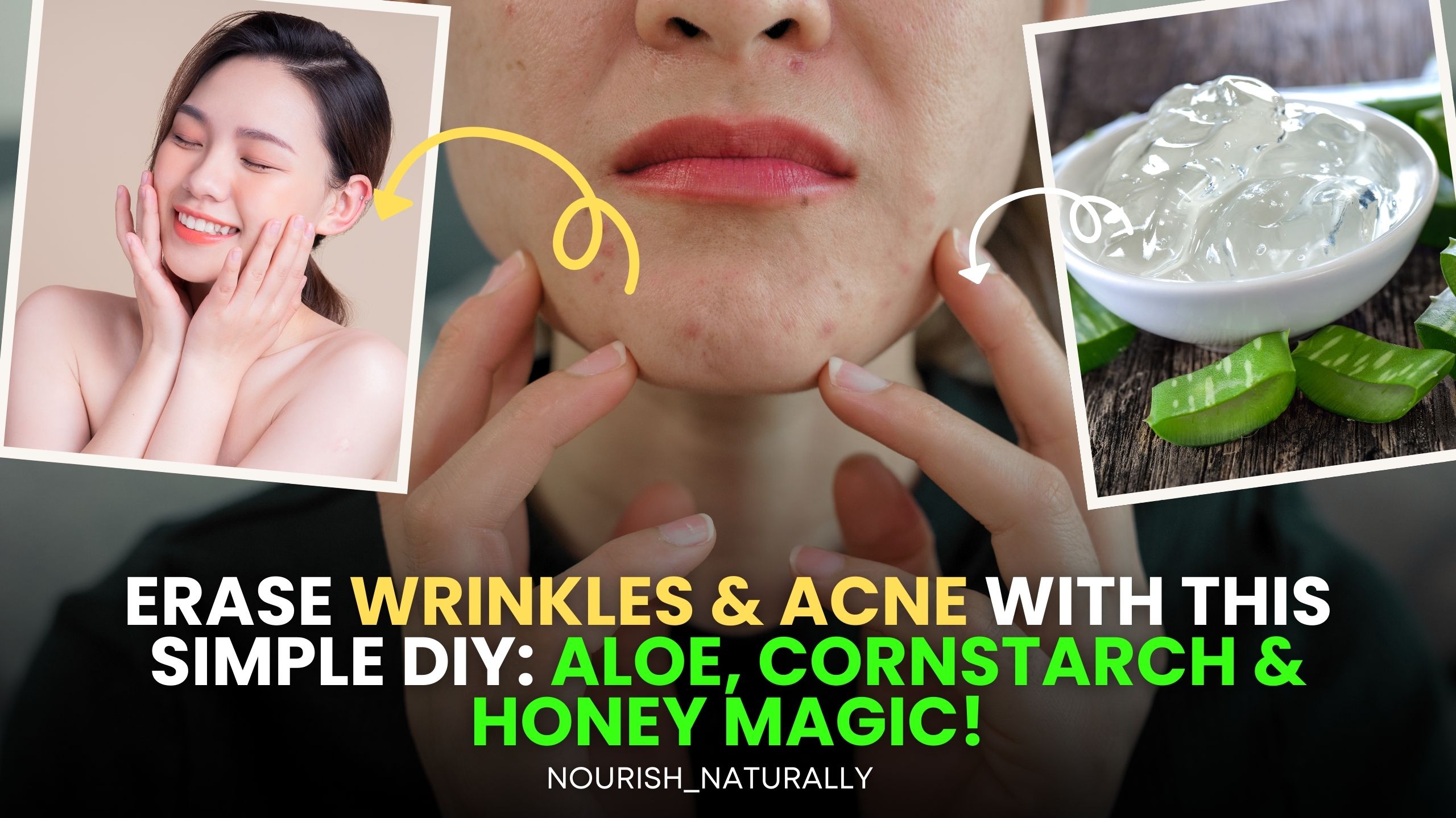 Video thumbnail for Erase Wrinkles & Acne with THIS Simple DIY: Aloe, Cornstarch & Honey Magic!