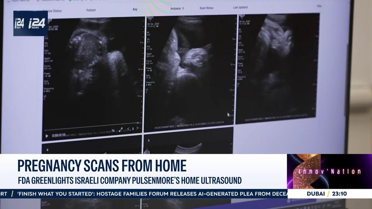 Video thumbnail for FDA approves Israeli company Pulsenmore's at-home ultrasound device in the US