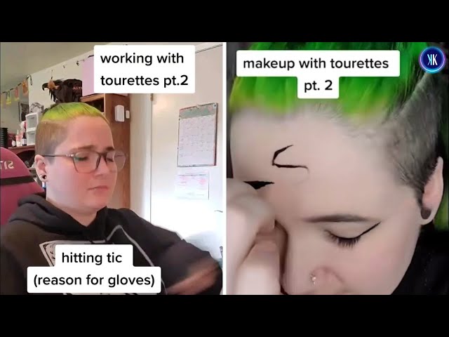 Video thumbnail for The People Faking Having Tourette's Syndrome