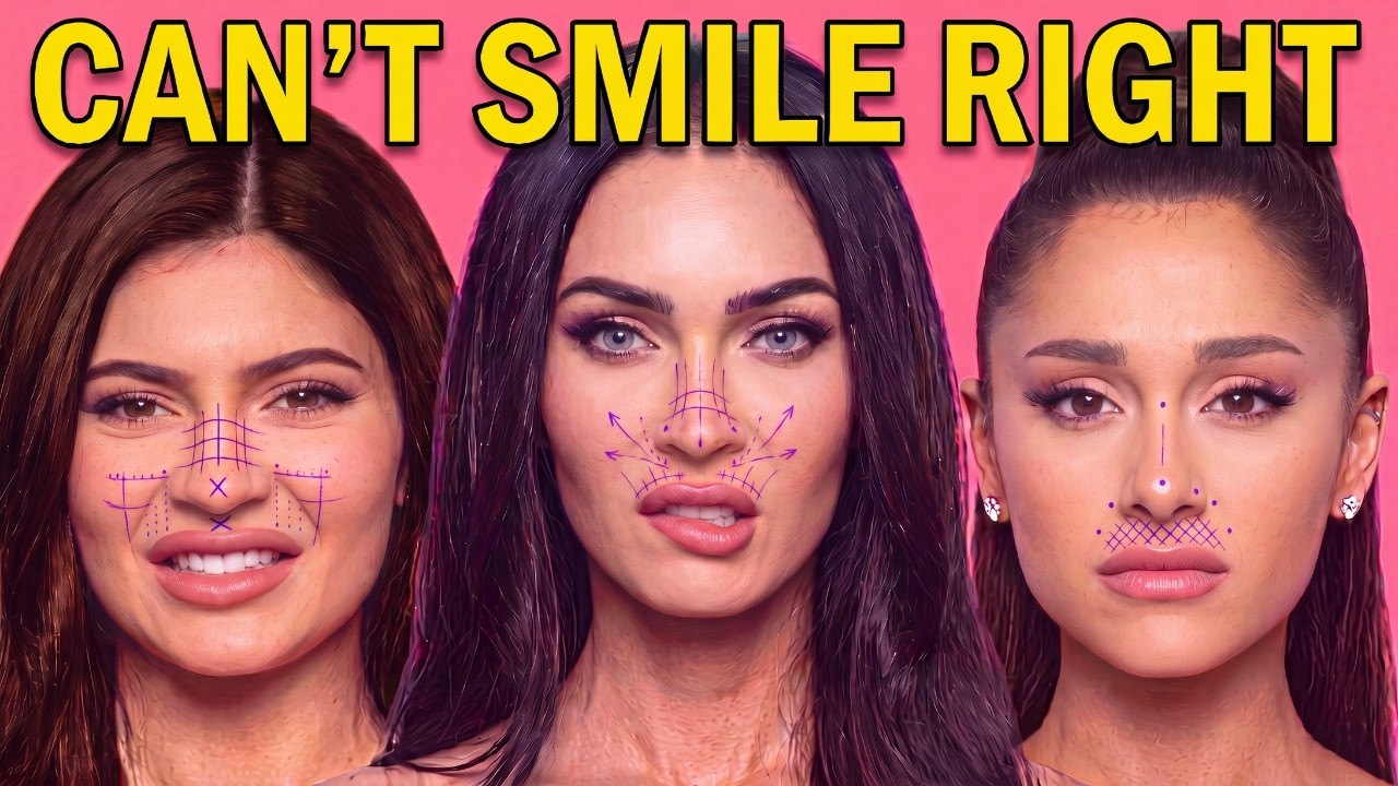 Video thumbnail for They Lifted Their Lips For Youth Now They Can't Smile Right