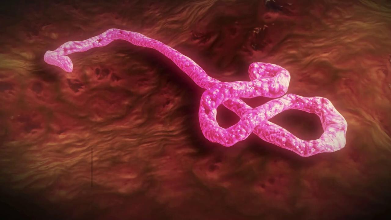 Video thumbnail for WHO Warns Ebola Vaccine Could Take Nine Months As Outbreak Worsens.