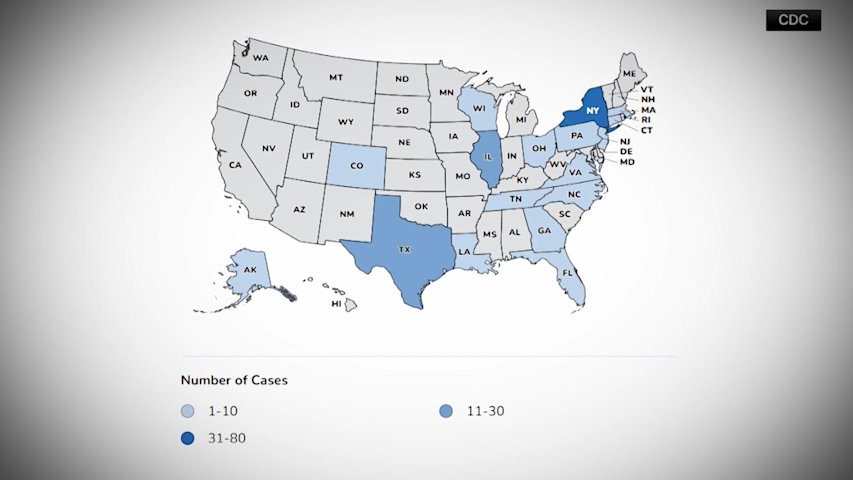 Video thumbnail for Connecticut cases of intestinal parasite rise to 30, health department says