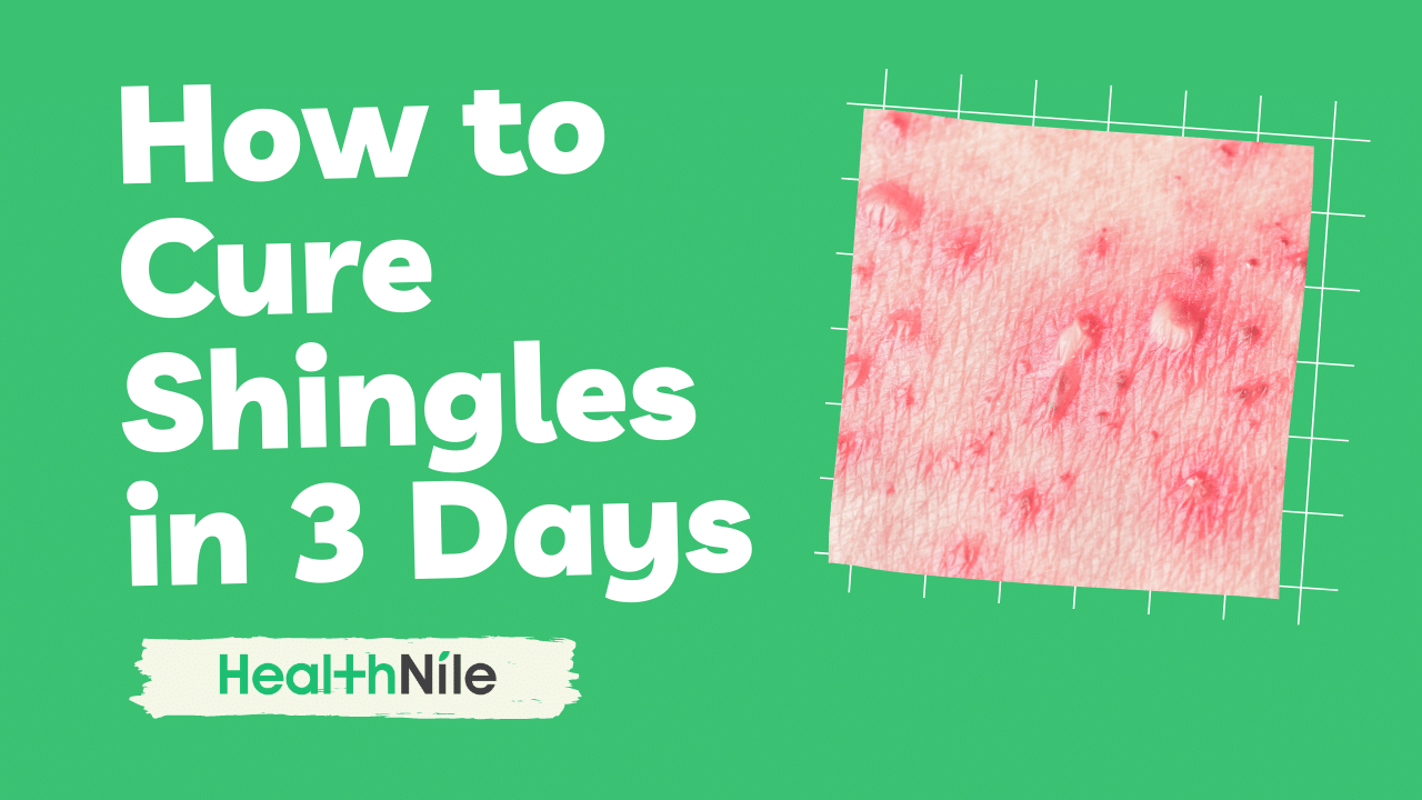 Video thumbnail for How to Cure Shingles in 3 Days