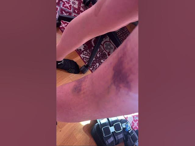 Video thumbnail for #rage 😠