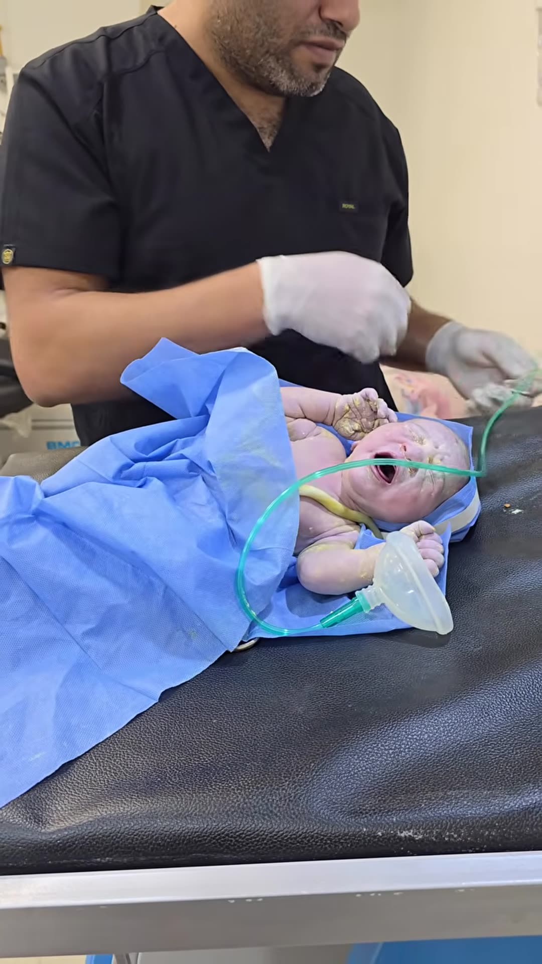 Video thumbnail for Baby born with respiratory distress(720P_HD)