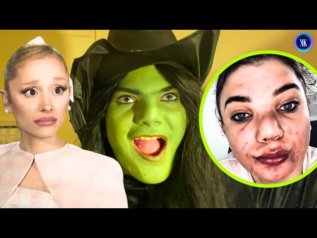 Video thumbnail for "Wicked" Fan Banned From Premier For Spreading Scabies