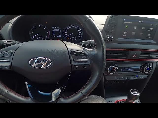Video thumbnail for How to Enable or Disable Start Stop Function in Hyundai Kona ( 2017 – now )