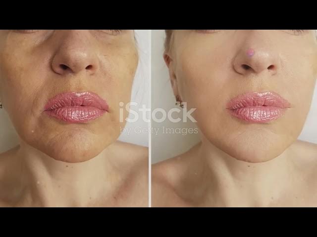 Video thumbnail for THE BEST LED BEAUTY TECH ON THE MARKET | HealthBeautyLondon.com