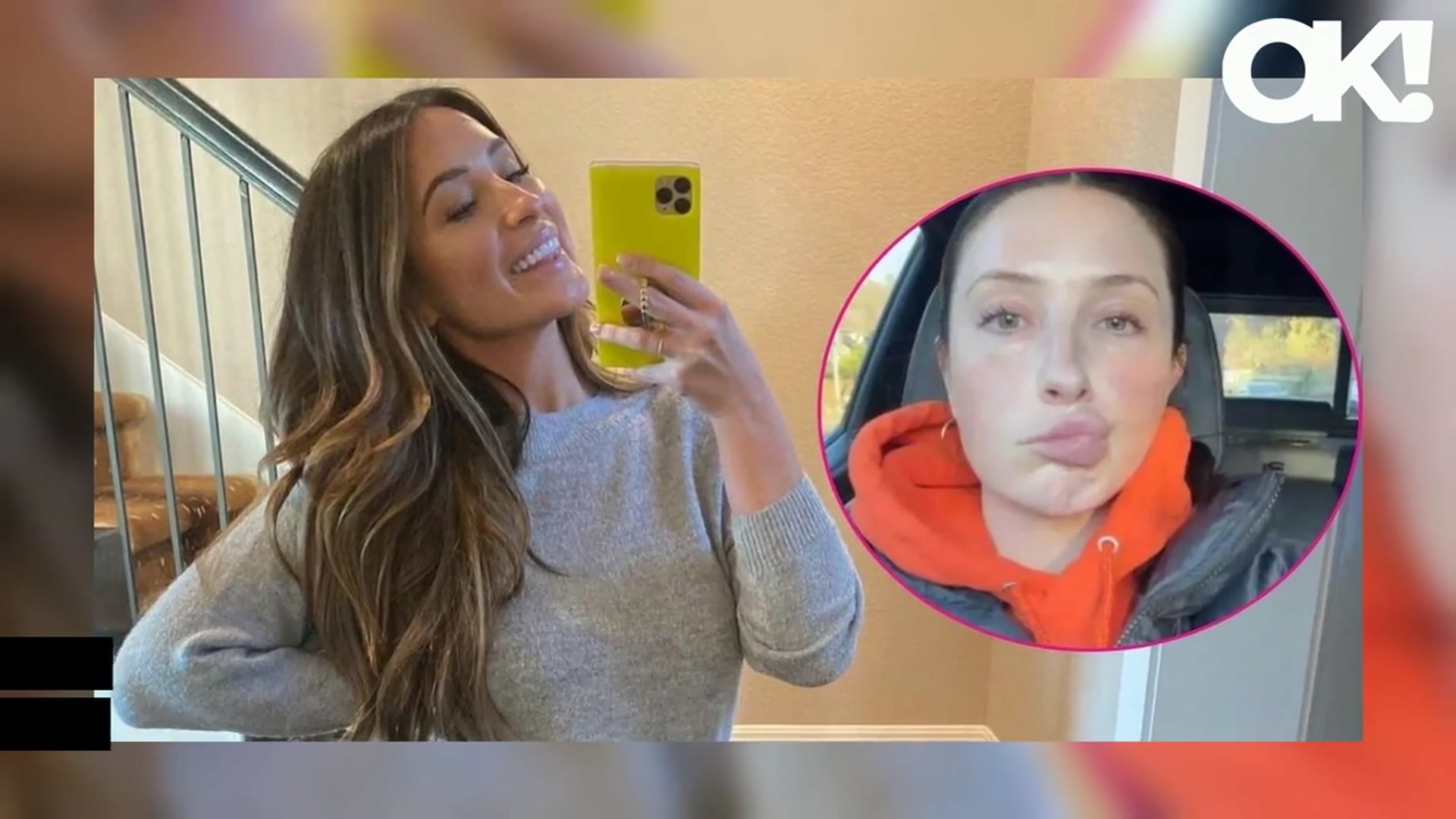 'Video thumbnail for Bristol Palin Reveals Her Face Is 'Slowly Getting Better' Amid Scary Facial Paralysis Condition'