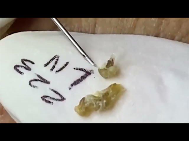 Video thumbnail for Satisfying Relaxing Relax Every SacDepSpa Hours #100006