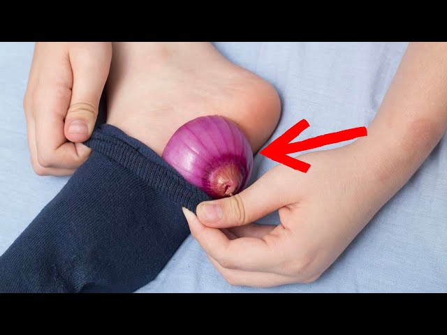 Video thumbnail for Put an Onion in Your Sock Before Bed And This is What Will Happen To Your Body !