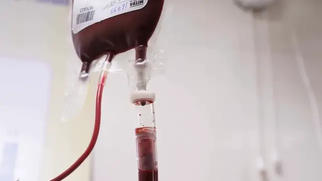 Video thumbnail for What Is Anemia in Kidney Disease?