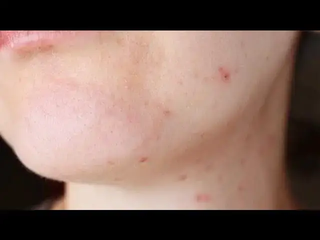 Video thumbnail for 10 Hilarious Sick Jokes & Puns to Brighten Your Day | Laugh Away Illness with Funny Humor