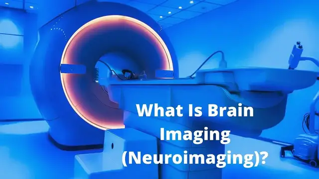 Video thumbnail for What Is Brain Imaging (Neuroimaging)?
