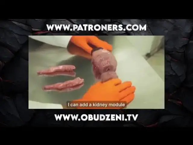 Video thumbnail for Ożywił martwą tkankę. Napisz w komentarzu czy Janusz przeżyje ?