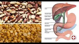 'Video thumbnail for Top Foods to Keep Your Liver Healthy'