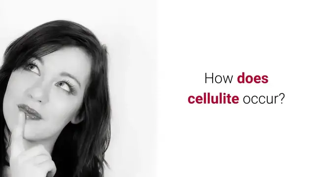 'Video thumbnail for How to Get Rid of Cellulite on Thighs and Bum (fast)'