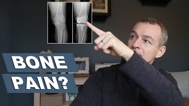 Video thumbnail for Why do I have bone pain after knee replacement surgery | First 12 weeks