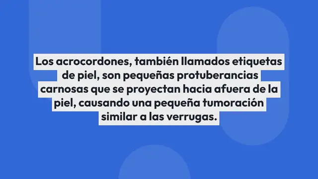 Video thumbnail for Cómo eliminar los acrocordones de forma natural