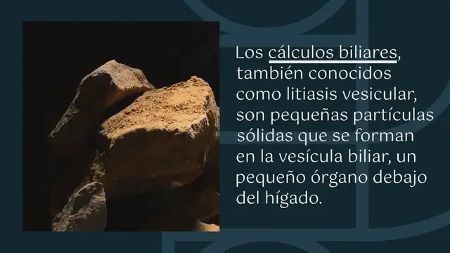 Video thumbnail for Estos son los primeros síntomas que se presentan por cálculos en la vesícula