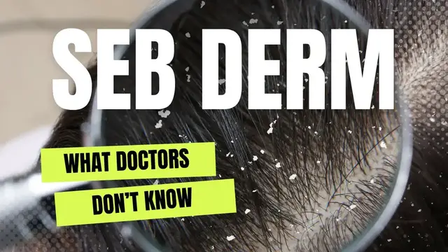 'Video thumbnail for What is Seborrheic Dermatitis?'