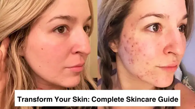 Video thumbnail for Transform Your Skin_ The Complete Skincare Guide