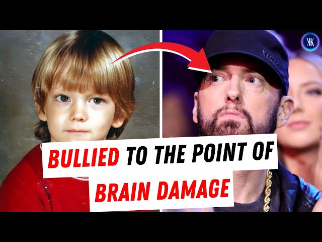 Video thumbnail for Eminem Wrote A Diss Track About His Childhood Bully, Got Sued For Defamation